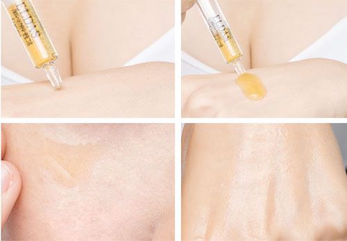 BỘ TẾ BÀO GỐC TÁI TẠO TRẺ HÓA LÀN DA ELDAS EG TOX PROGRAM