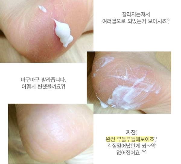  Kem Dưỡng Da Chân 3W Clinic Enrich Foot Treatment